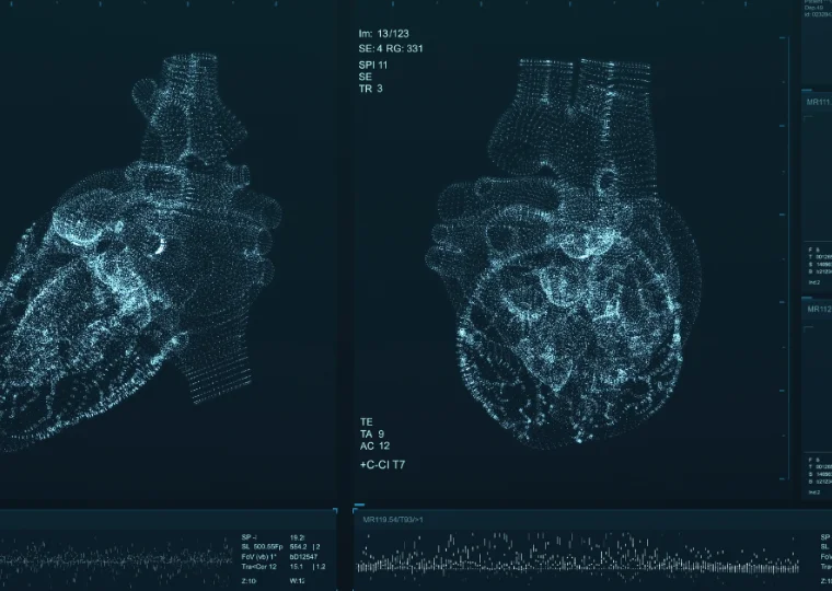 L’intelligenza artificiale aiuta a prevenire l’infarto, guardando il cuore