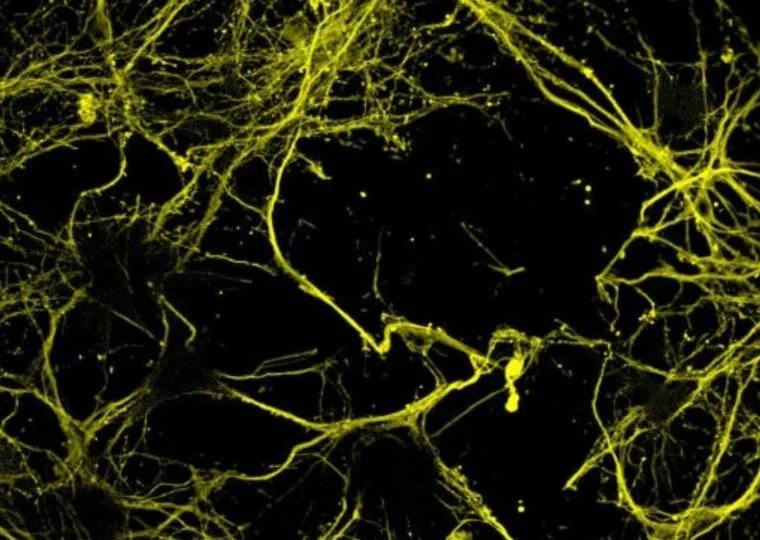 Stimolazione cerebrale a ultrasuoni: studiare emozioni e processi decisionali nel cervello umano