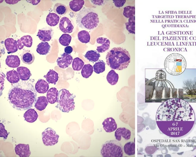 Corso  “La sfida delle Targeted Therapies nella pratica clinica quotidiana: la gestione del paziente con leucemia linfatica cronica”
