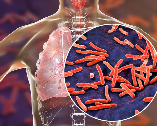 UniSR partner di UNITE4TB per lo sviluppo di terapie contro la tubercolosi